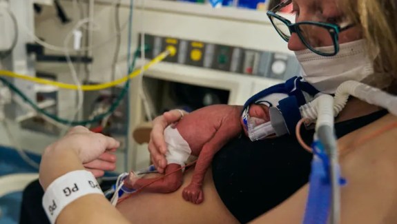 Person with a premature infant on their chest in a hospital setting. The baby is wearing a diaper, and has tubes and a ventilator