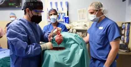Surgeon Muhammad M Mohiuddin leads a team placing a genetically-modified pig heart into a storage device at the Xenotransplant lab before its transplant on David Bennett, on 7 January. Photograph: UMSOM/Reuters