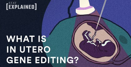 Cover graphic for video of a fetus in utero with a needle inserts into womb