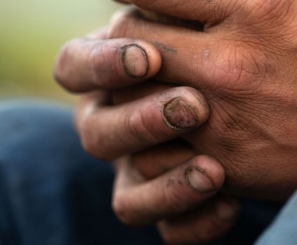 Dirty hands and finger nails clasped together