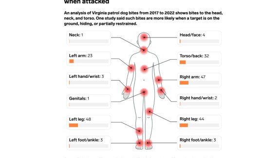 Graphic showing human body highlighting locations of most frequent dog bites indicating frequency of bite