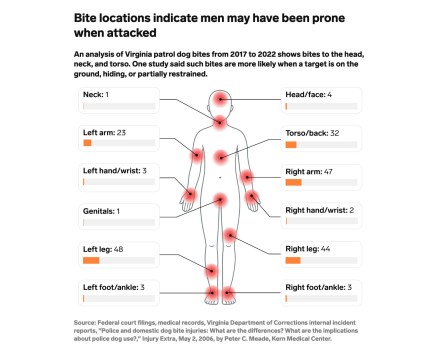 Graphic showing human body highlighting locations of most frequent dog bites indicating frequency of bite