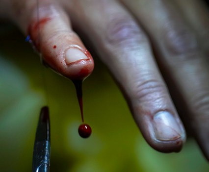 A dirty hand drips blood from the little finger